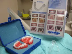 Invisalign