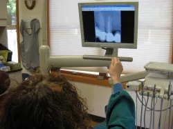 Digital Xrays